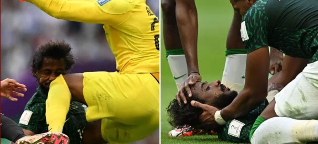 Cầu thủ Ả Rập bị chấn thương